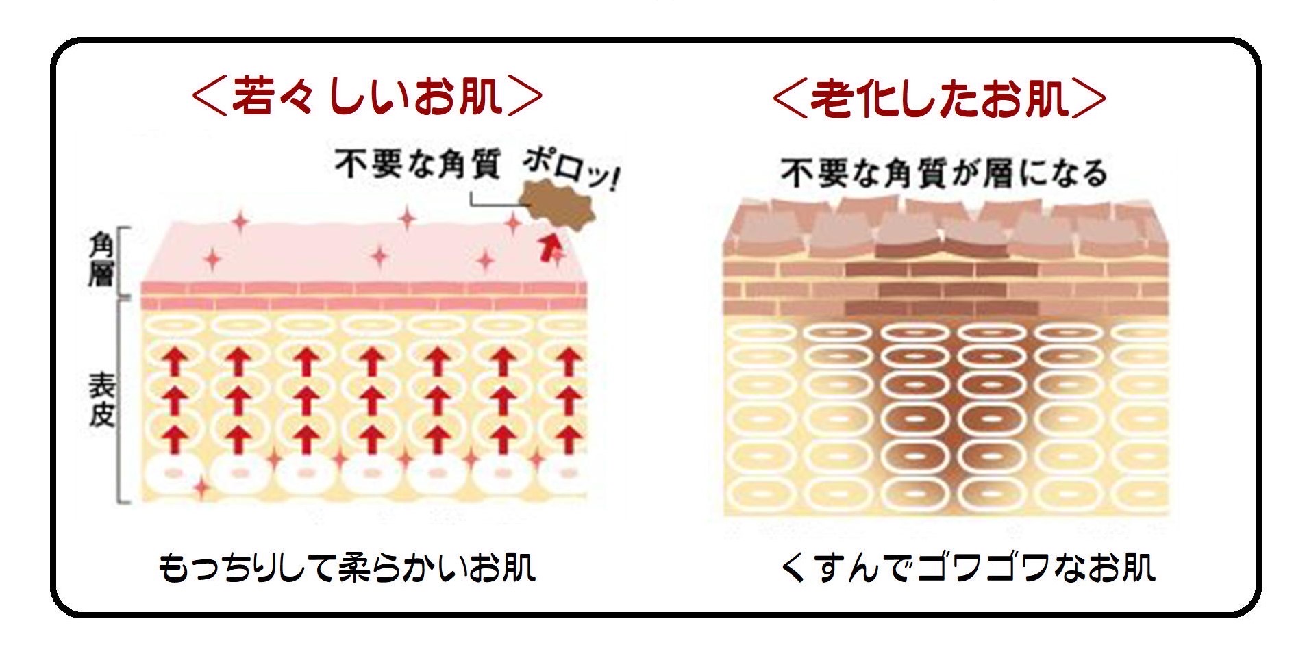 若々しいお肌と老化したお肌の比較図